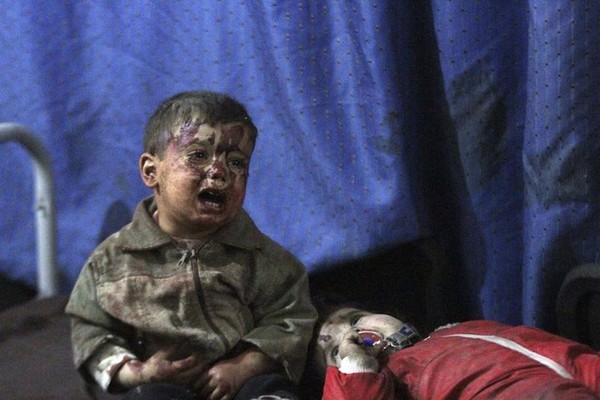 Hai em bé Syria bị thương do chiến tranh khóc nức nở khi được đưa đến bệnh viện điều trị vào ngày 15/3/2015